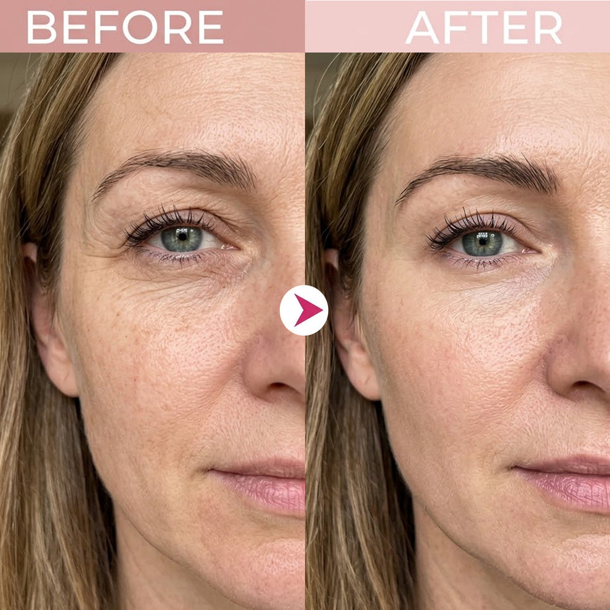 🔥Final 2 Hour 76% OFF🔥 P7 Eye Renewal Crème